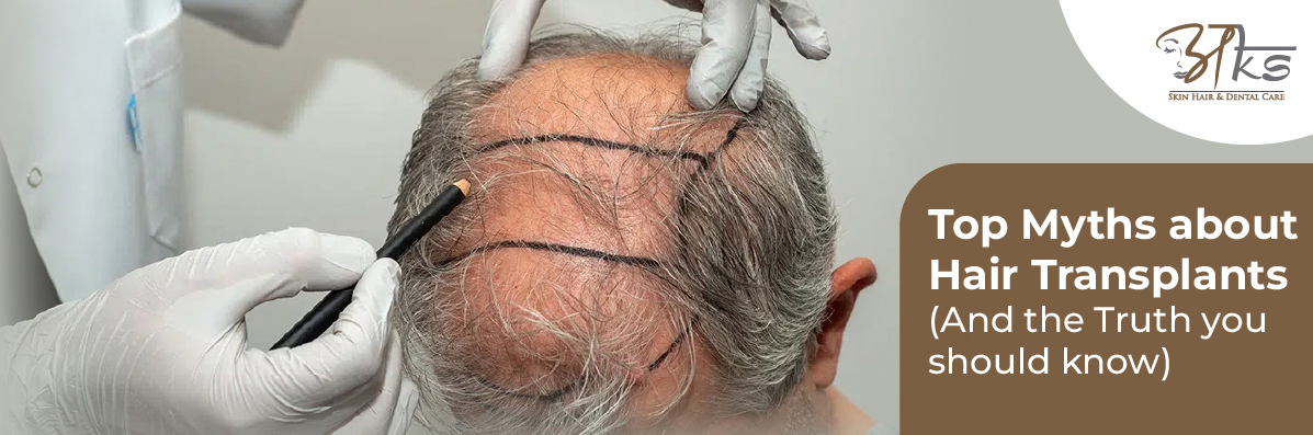 Top Myths About Hair Transplants (And the Truth You Should Know) Myths About Hair Transplants