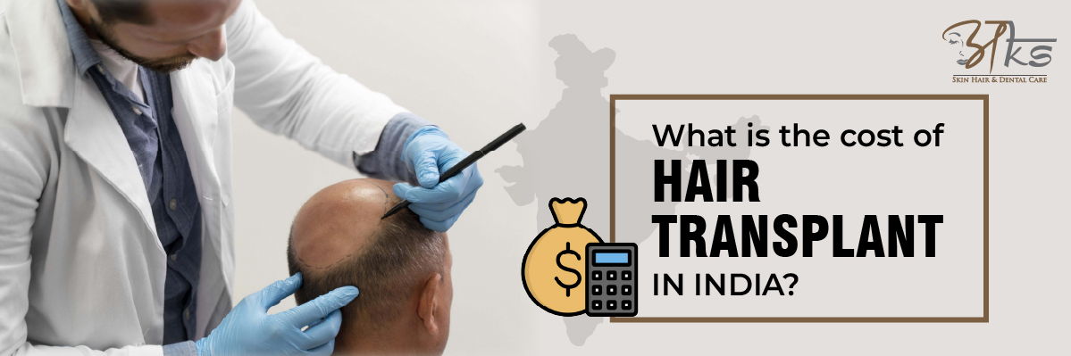 Cost of Hair Transplant