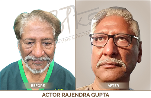 Actor Rajendra Gupta