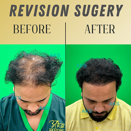 AKS clinic Before and After 3 AKS clinic Before and After 3