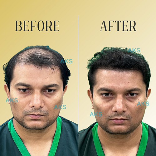 AKS clinic Before and After 5 AKS clinic Before and After 5
