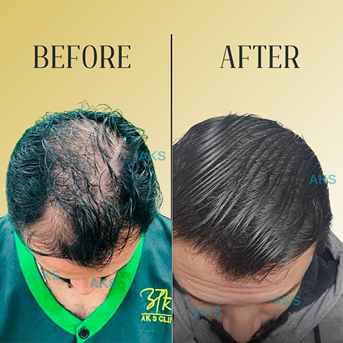 AKS clinic Before and After 4 AKS clinic Before and After 4