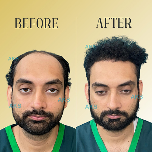 AKS clinic Before and After 6 AKS clinic Before and After 6