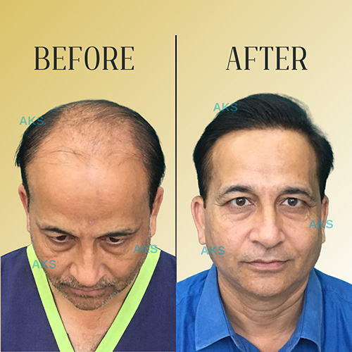 AKS clinic Before and After 7 AKS clinic Before and After 7