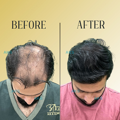 AKS clinic Before and After 8 AKS clinic Before and After 8