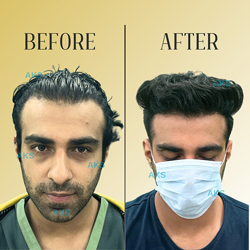 AKS clinic Before and After 9 AKS clinic Before and After 9