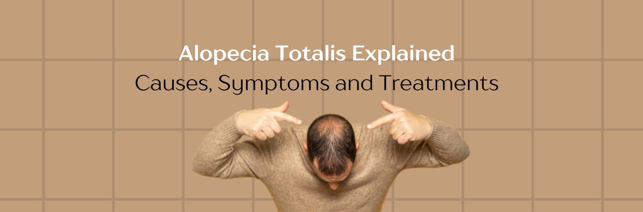 Alopecia Totalis