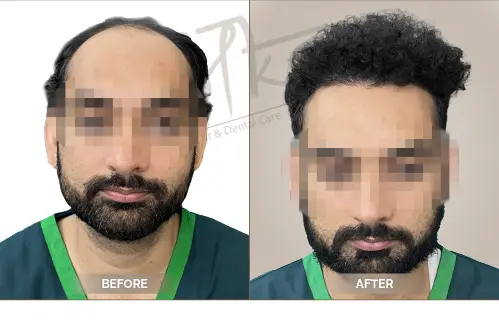 AKS Clinic Before and After