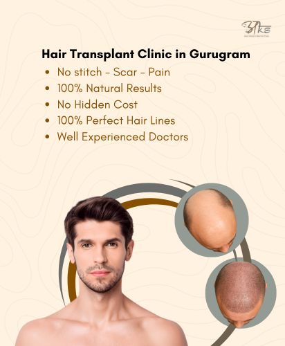 Hair Transplant Clinic Gurgaon