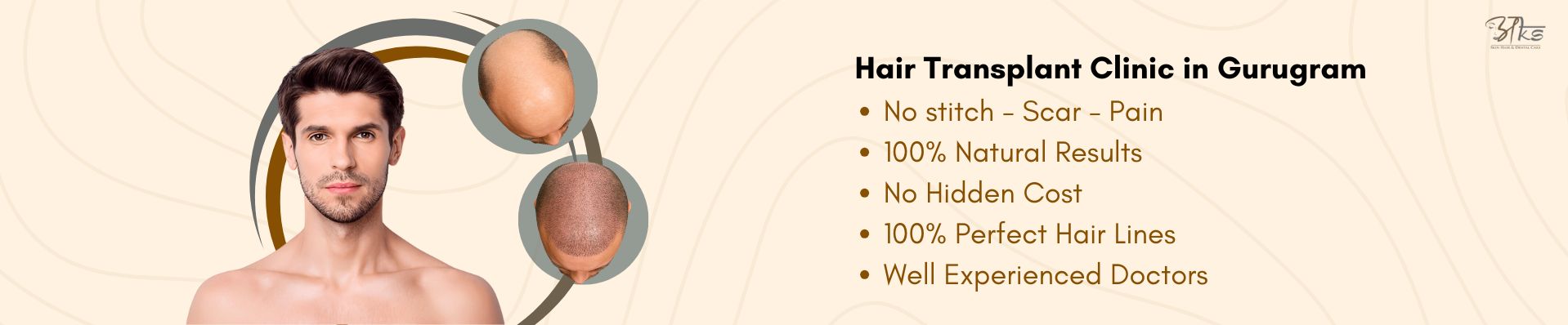 Hair Transplant Clinic Gurgaon