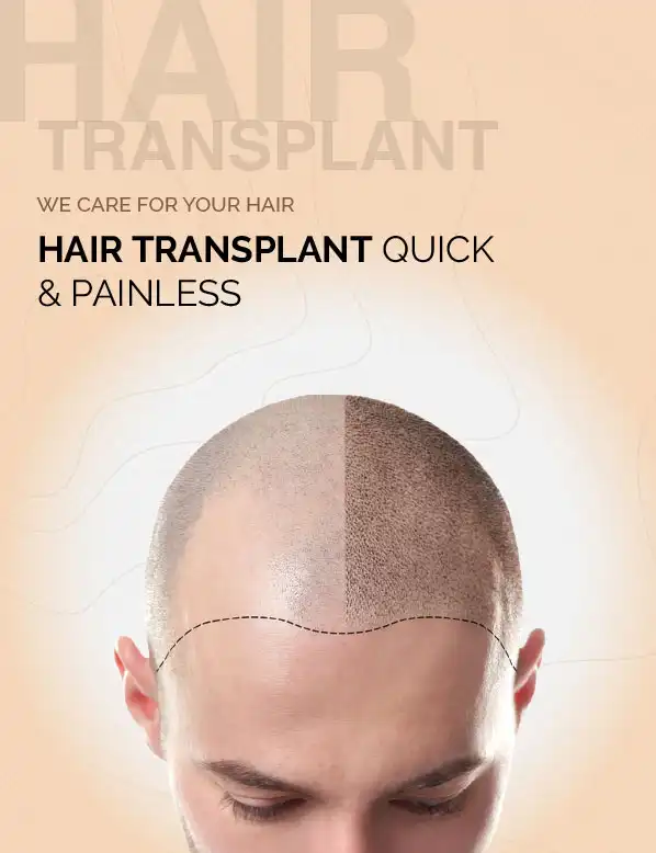Direct Hair Transplant